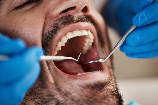 Best Emergency Care for Gum Disease in Buchanan Dam, TX